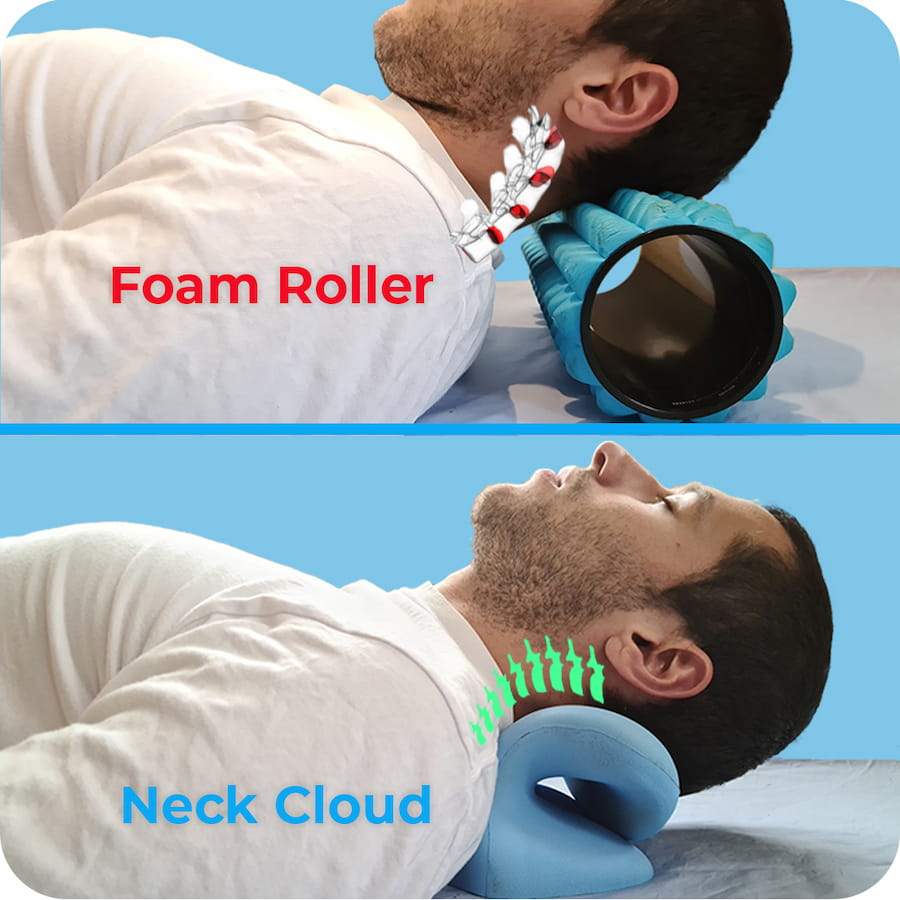 Neck cloud before and after